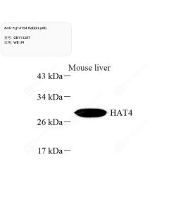 Anti-FLJ14154 Rabbit pAb servicebio GB113287-50