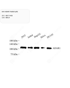 Anti-ADAR1 Rabbit pAb servicebio GB111458-50