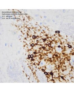 Recombinant Anti-Tyrosine Hydroxylase antibody (Rabbit mAb) servicebio GB15182-100
