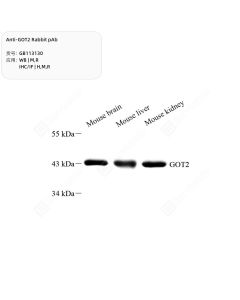 Anti-GOT2 Rabbit pAb servicebio GB113130-100