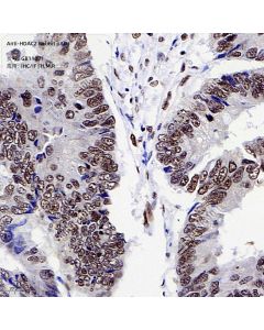 Anti-HDAC2 Rabbit pAb servicebio GB11371-100