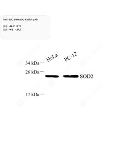 Anti-SOD2/MnSOD Rabbit pAb servicebio GB111875-50