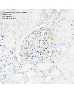 Recombinant Anti-VEGFA antibody (Rabbit mAb) servicebio GB15165-50