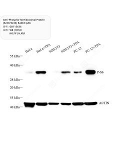 Anti-Phospho-S6 Ribosomal Protein (S240/S244) Rabbit pAb servicebio GB115636-100