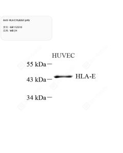 Anti-HLA E Rabbit pAb servicebio GB112510-50