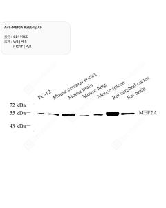 Anti-MEF2A Rabbit pAb servicebio GB11965-100