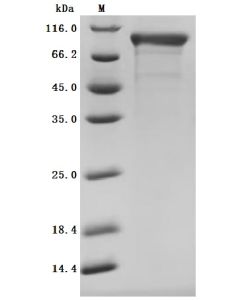 Recombinant Macaca fascicularis Cadherin 6(CDH6),partial (Active) CSB-MP4958MOV CUSABIO