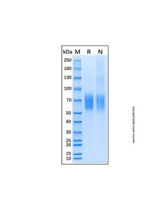 Recombinant Mouse IL-23R Protein rp154193-10μg Aladdin