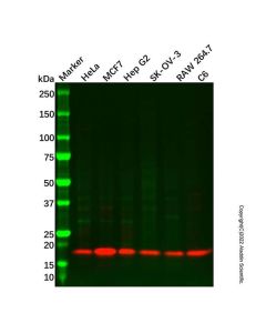 Recombinant Calmodulin 1/2/3 Antibody - Primary antibody, specific to CALM1/ CALM2/ CALM3, Rabbit IgG Ab092494-10μl Aladdin