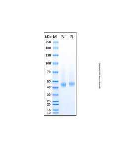 Recombinant Mouse Decorin Protein rp153874-10μg Aladdin