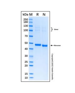Recombinant Human Pax6 Protein rp214452-10μg Aladdin