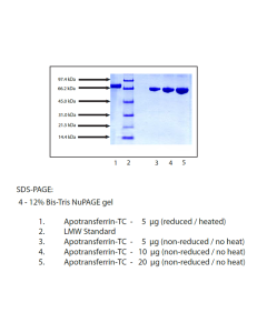 Transferrin (APO) from Human Plasma, CAS No.11096-37-0 np001126-50mg Aladdin