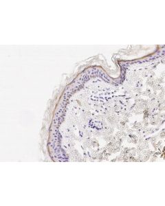 Cystatin E/CST6 Monoclonal Antibody (AN200026P) elabscience