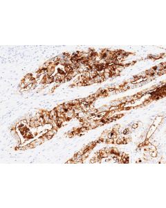 Recombinant CEACAM5/CD66e Monoclonal Antibody (AN300374P) elabscience