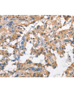 SCARB1 Polyclonal Antibody (E-AB-10361) elabscience
