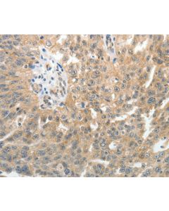 E-Selectin Polyclonal Antibody (E-AB-10570) elabscience