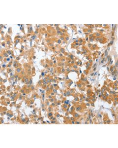 CHMP4B Polyclonal Antibody (E-AB-11081) elabscience