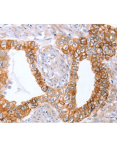 ABO Polyclonal Antibody (E-AB-13092) elabscience