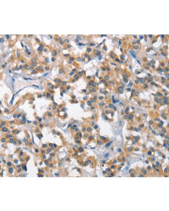 SCARB1 Polyclonal Antibody (E-AB-14121) elabscience