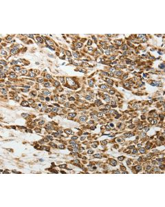E-Selectin Polyclonal Antibody (E-AB-14325) elabscience