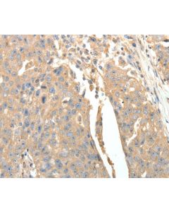 SFTPD Polyclonal Antibody (E-AB-14367) elabscience