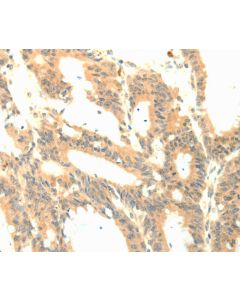 P23 Polyclonal Antibody (E-AB-14420) elabscience