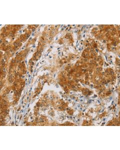 CENPE Polyclonal Antibody (E-AB-16335) elabscience