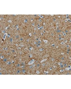 PGLYRP1 Polyclonal Antibody (E-AB-16706) elabscience