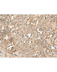 FSTL5 Polyclonal Antibody (E-AB-17977) elabscience
