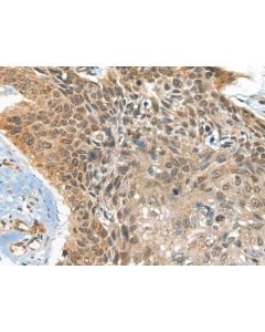BOLA1 Polyclonal Antibody (E-AB-18542) elabscience
