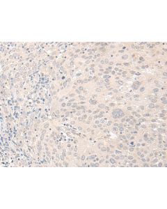 FOXRED2 Polyclonal Antibody (E-AB-18745) elabscience