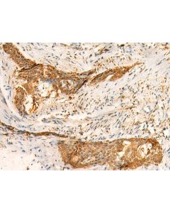 SMUG1 Polyclonal Antibody (E-AB-18918) elabscience