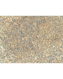 FMNL2 Polyclonal Antibody (E-AB-18919) elabscience