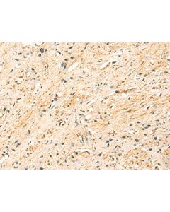 EEF1AKMT2 Polyclonal Antibody (E-AB-18929) elabscience