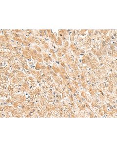 TRUB1 Polyclonal Antibody (E-AB-18992) elabscience