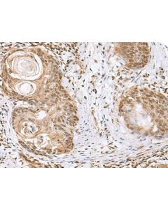 ELAC1 Polyclonal Antibody (E-AB-18999) elabscience