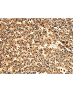 TMOD1 Polyclonal Antibody (E-AB-19254) elabscience