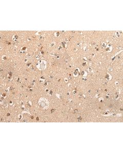 DYNAP Polyclonal Antibody (E-AB-19639) elabscience
