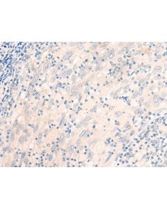 EME2 Polyclonal Antibody (E-AB-19801) elabscience