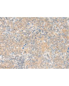 GALP Polyclonal Antibody (E-AB-19891) elabscience