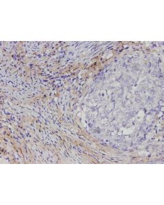 COL1A1 Polyclonal Antibody (E-AB-40665) elabscience