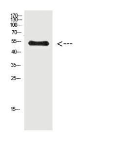 Phospho-Vimentin (Tyr38) Polyclonal Antibody (E-AB-51042) elabscience