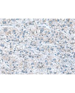 GDF9 Polyclonal Antibody (E-AB-52152) elabscience