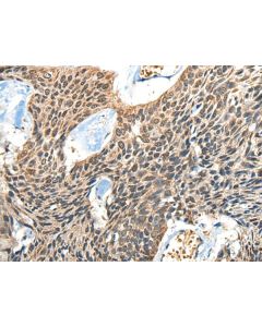 BOLA1 Polyclonal Antibody (E-AB-52476) elabscience