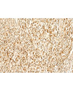 SMUG1 Polyclonal Antibody (E-AB-52829) elabscience