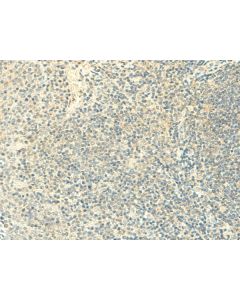 FMNL2 Polyclonal Antibody (E-AB-52830) elabscience