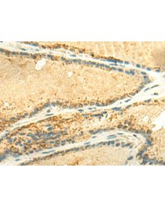 EEF1AKMT2 Polyclonal Antibody (E-AB-52841) elabscience
