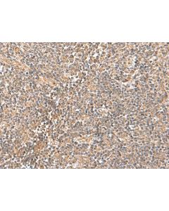 TRUB1 Polyclonal Antibody (E-AB-52904) elabscience