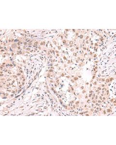 ZNF559 Polyclonal Antibody (E-AB-52985) elabscience