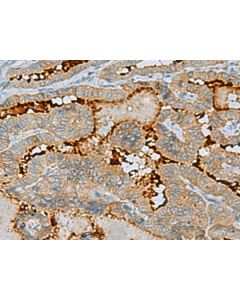 ENKD1 Polyclonal Antibody (E-AB-53159) elabscience